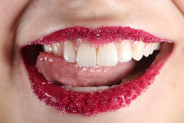 Teeth whitening will make your smile more attractive