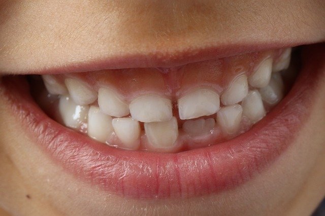 Child's smiling mouth, showing teeth