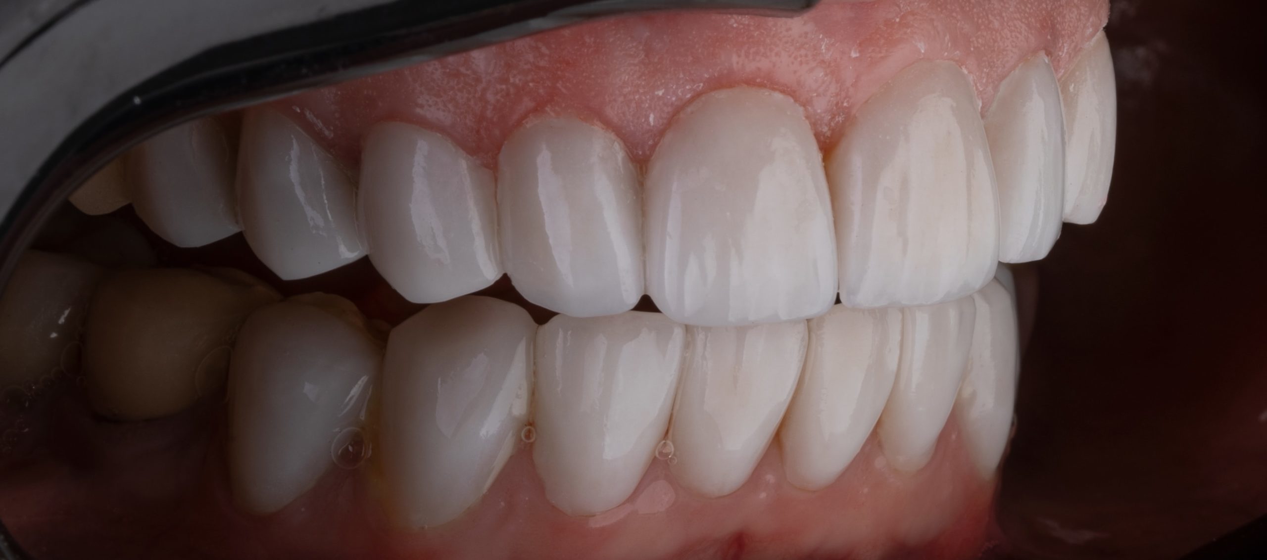 Full view of teeth