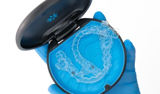 Uncover A Radiant Smile With Clear Aligners