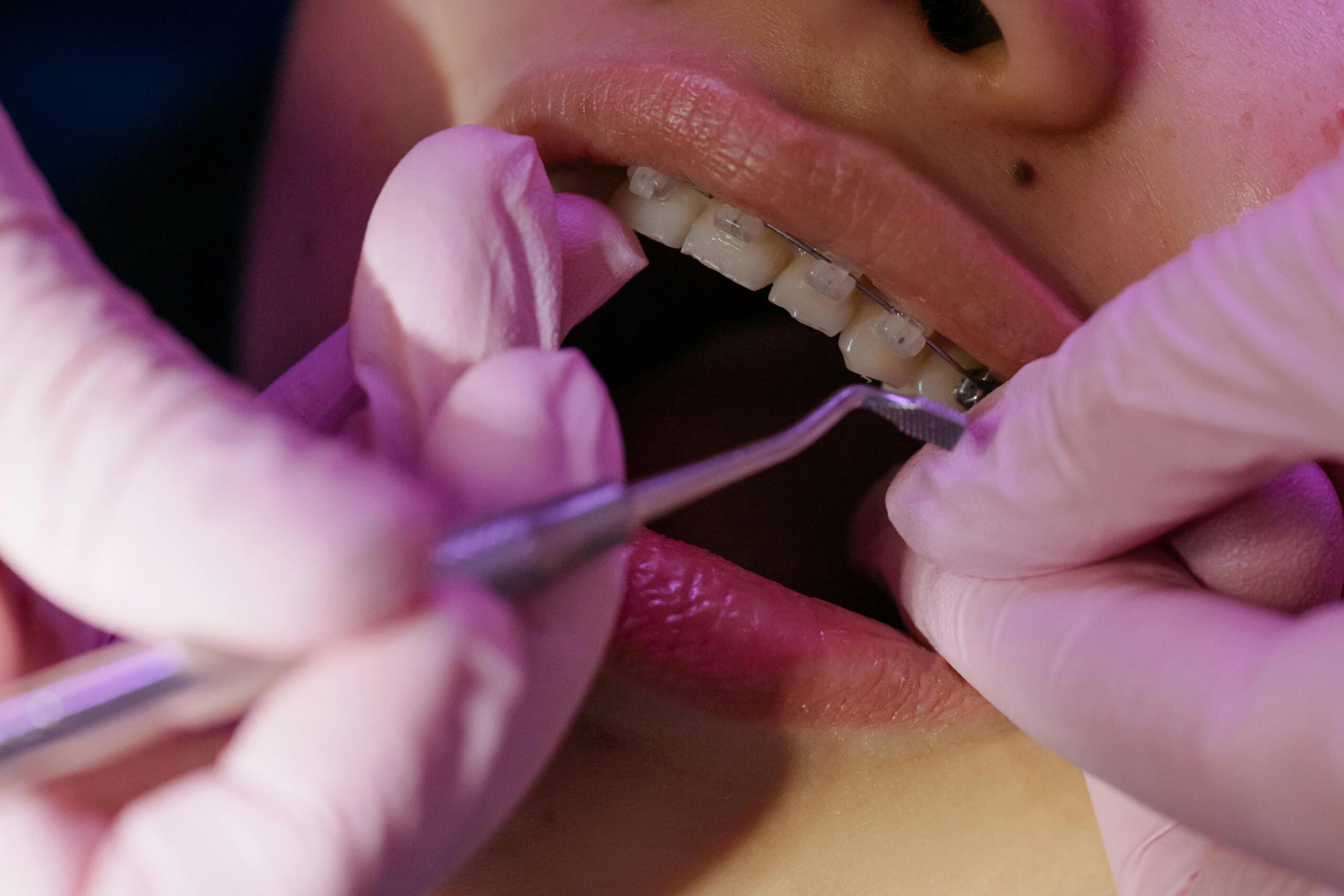 Dentist checking a patients teeth