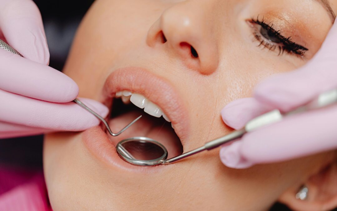 What to Expect at a Routine Dental Examination