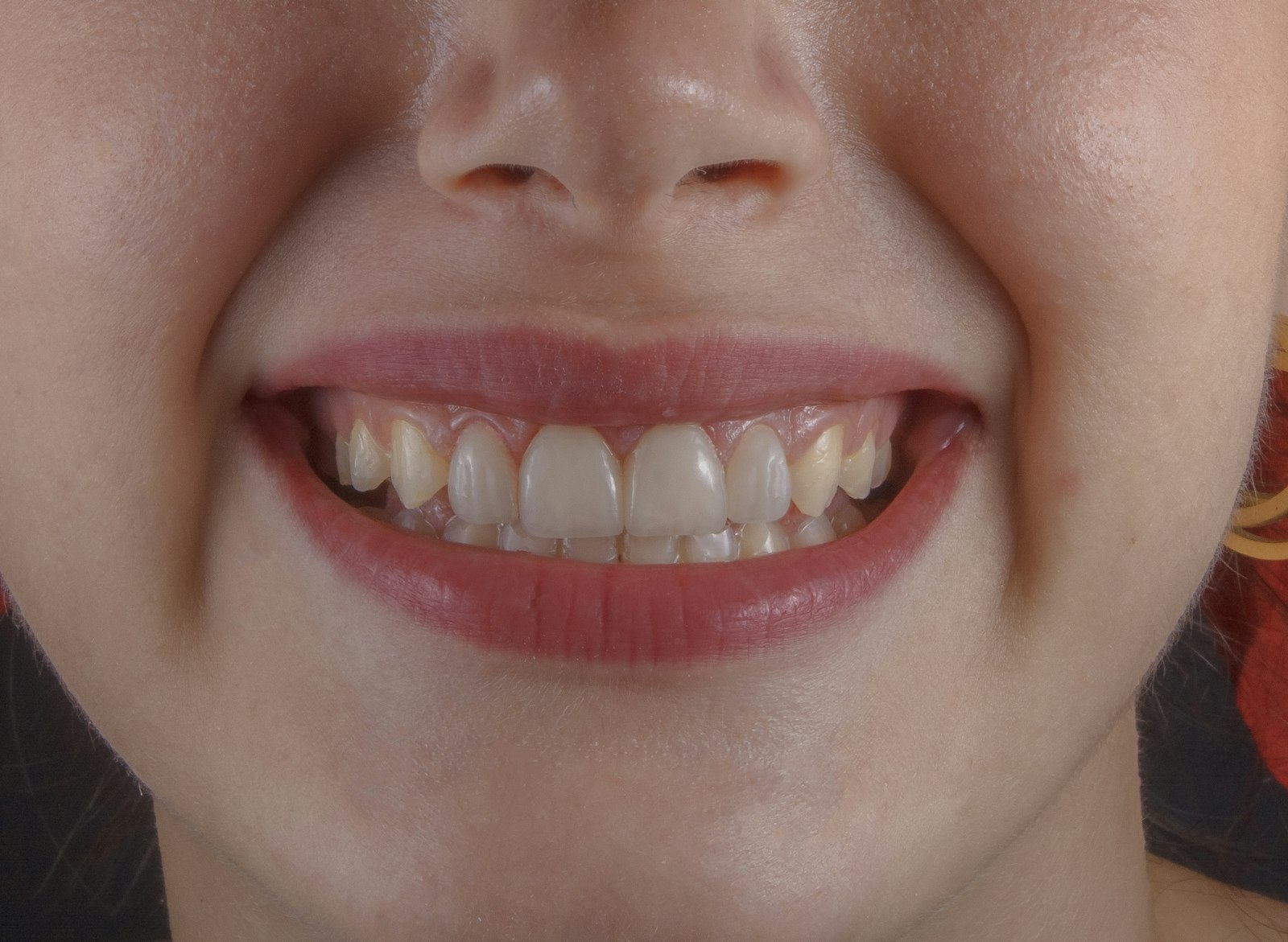 freestocks-Qx5QNarbrUM-unsplash A close up of a person's mouth