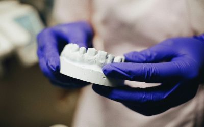 How Long Do Crowns Last on a Tooth?