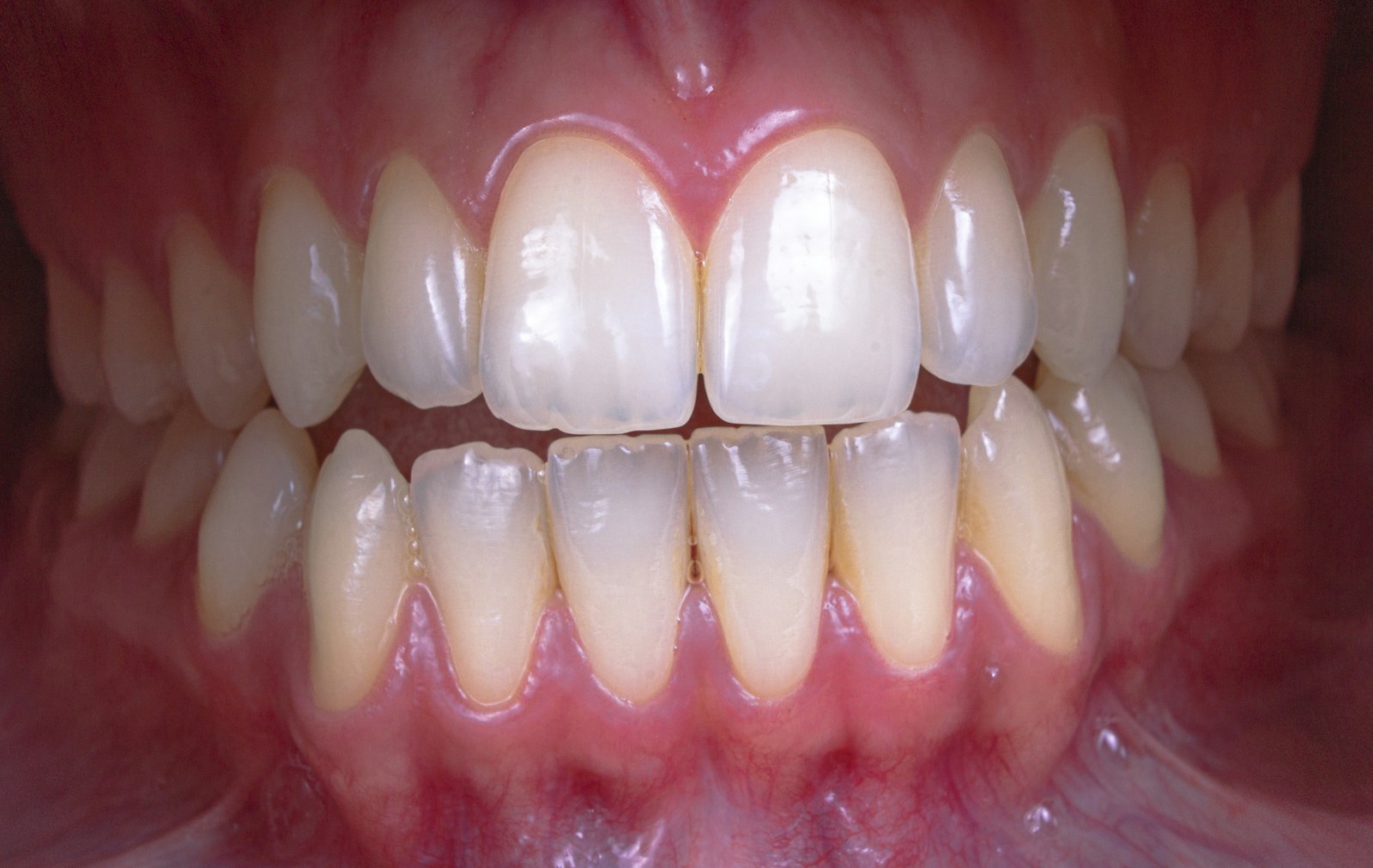 A close up of a person's mouth