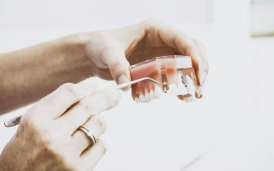 How to Wash Dentures Without Damaging Them