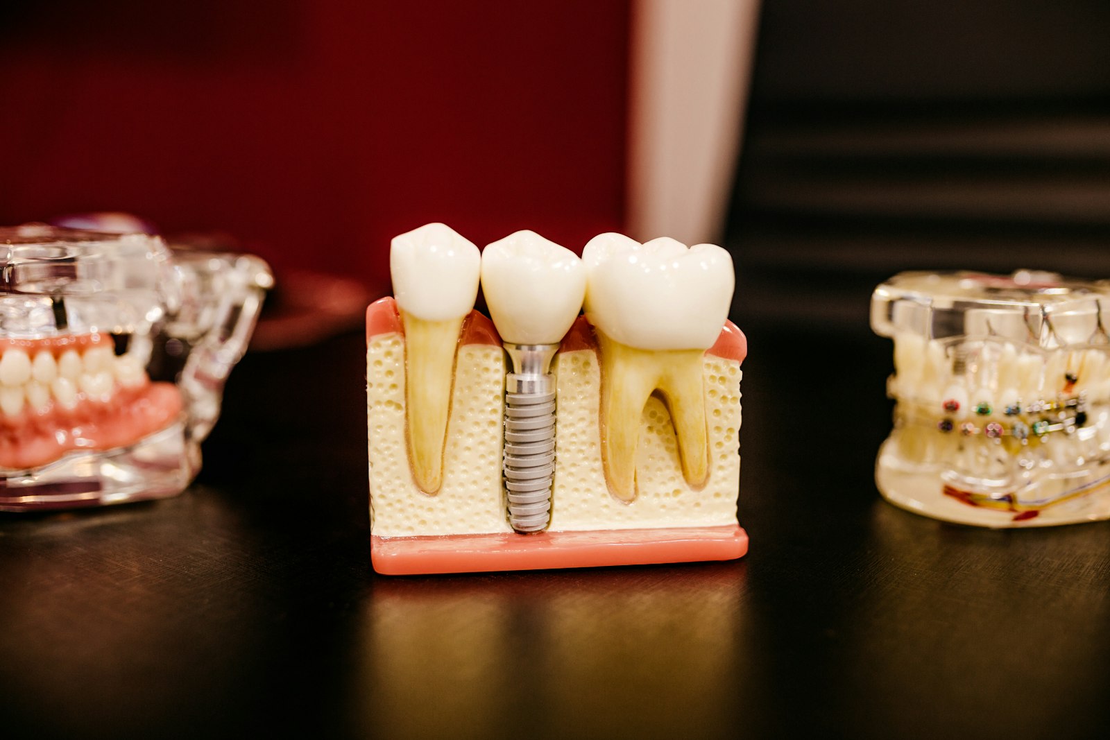 freestocks-Qx5QNarbrUM-unsplash Dental implant model with teeth