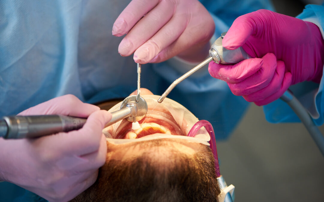 Why You Should Avoid Dairy After Oral Surgery