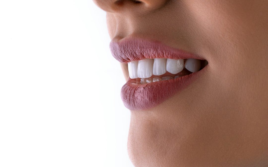 Are Teeth Whitening Strips Safe?
