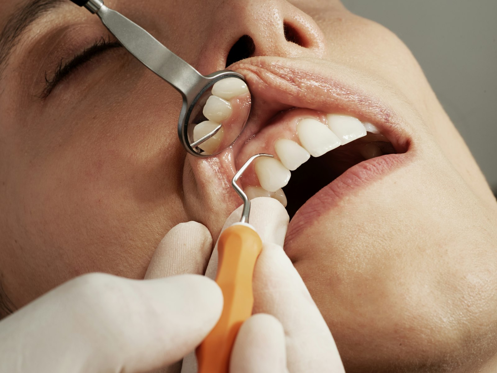freestocks-Qx5QNarbrUM-unsplash Dental exam with mirror and tool