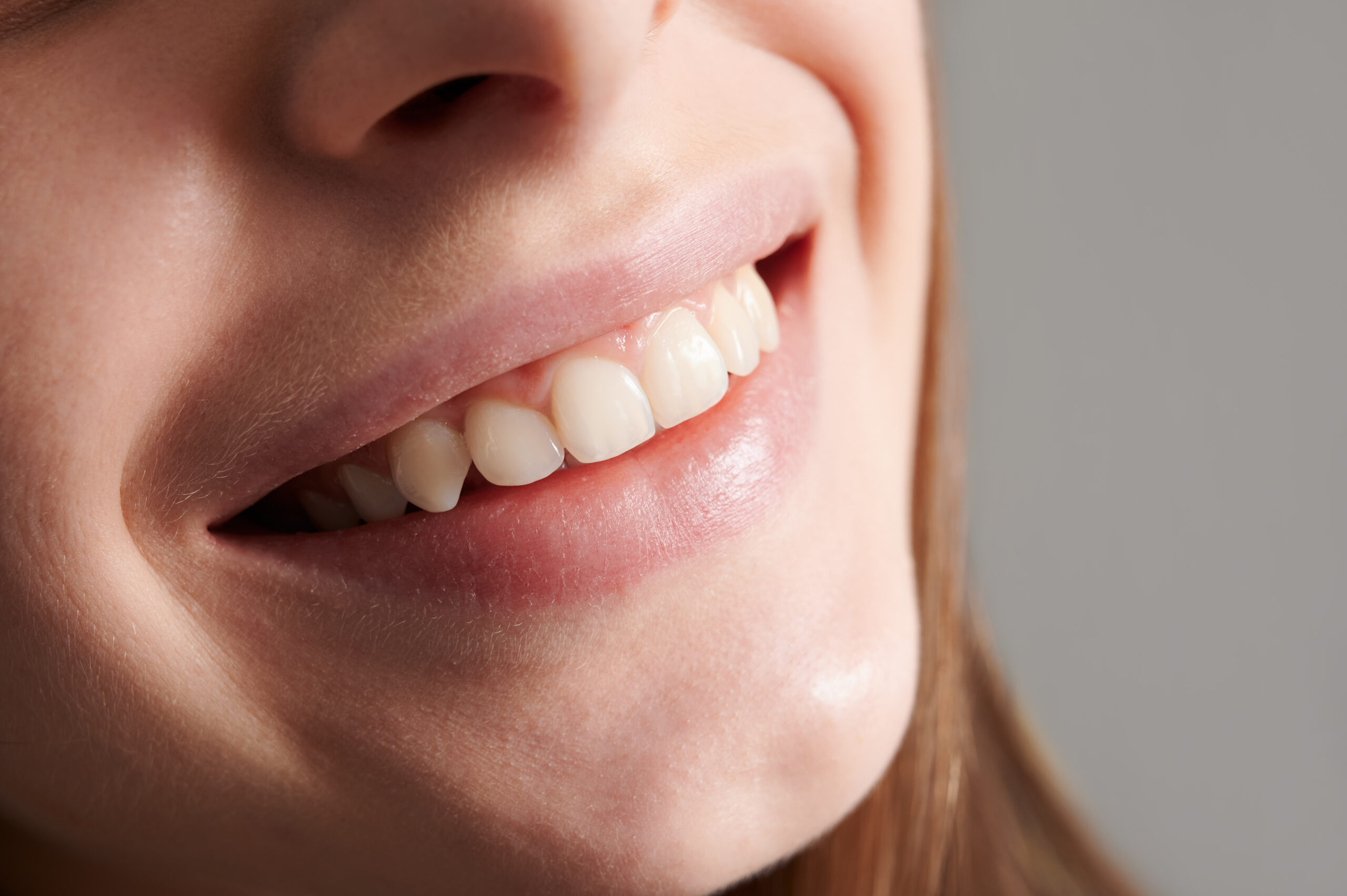 Smile with confidence with our white fillings