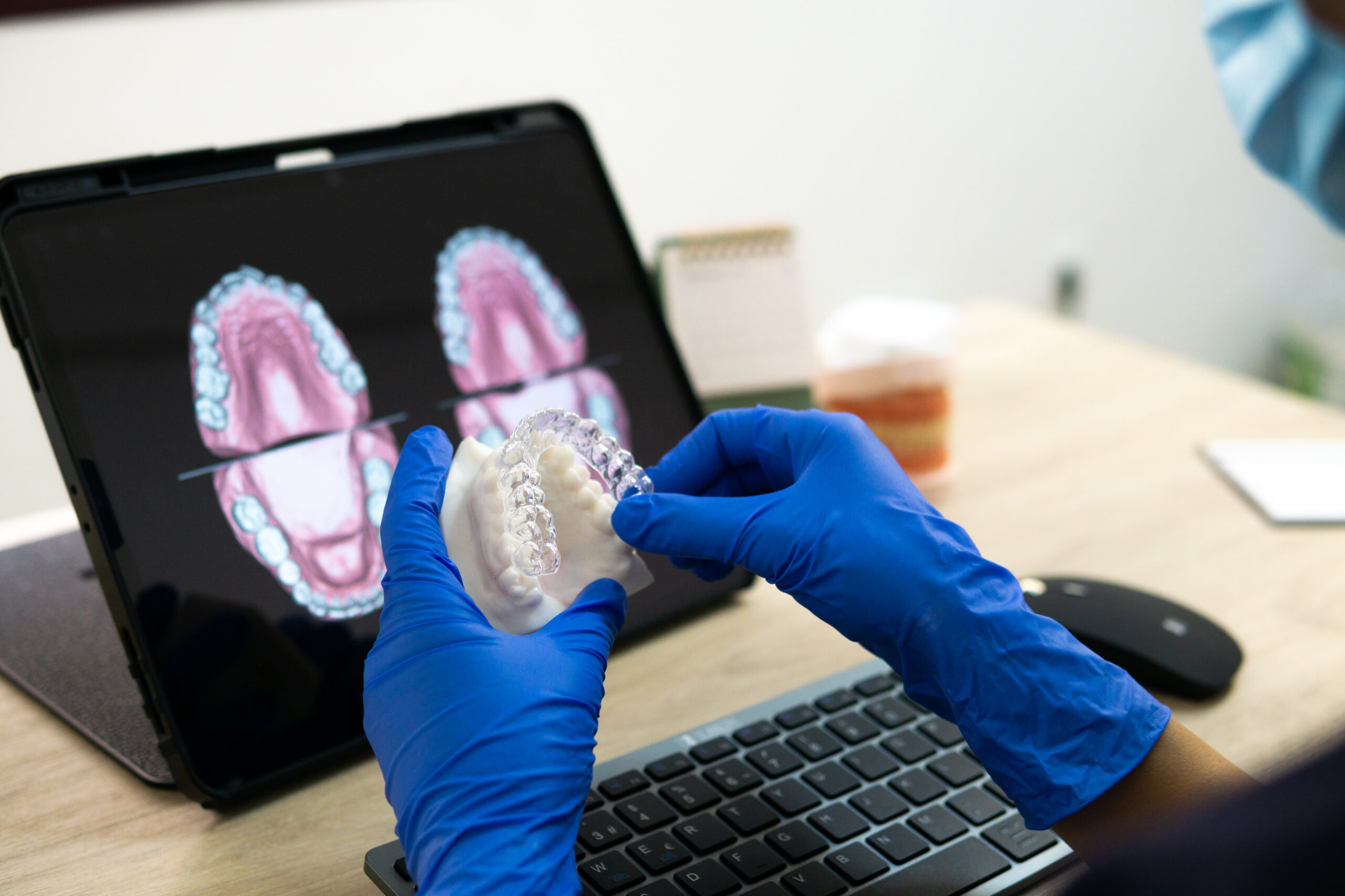 iTero Dental Scanner used in teeth straightening patient