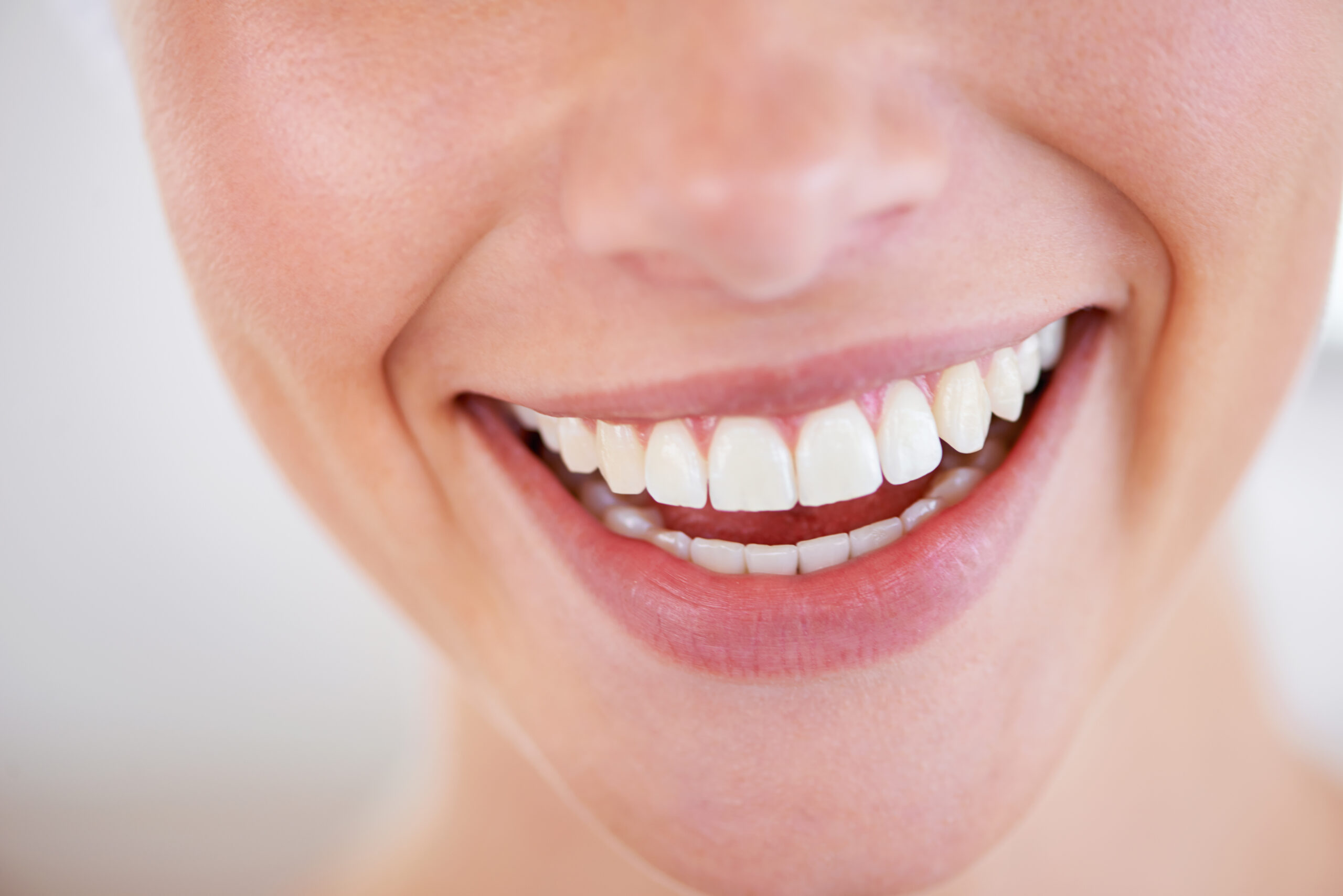 White fillings will give you an amazing smile